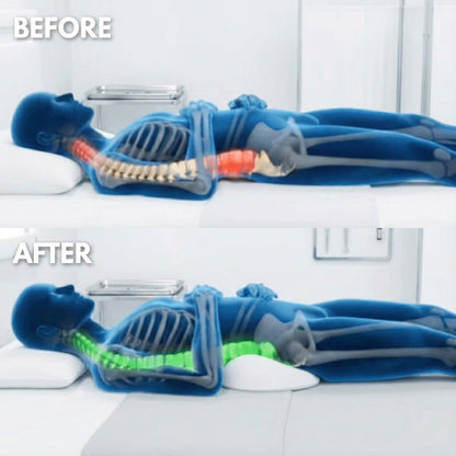 Alignex Pro™ Back Pain Pillow