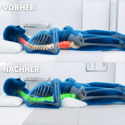 Alignex Pro™ Kissen bei Spinalkanalstenose